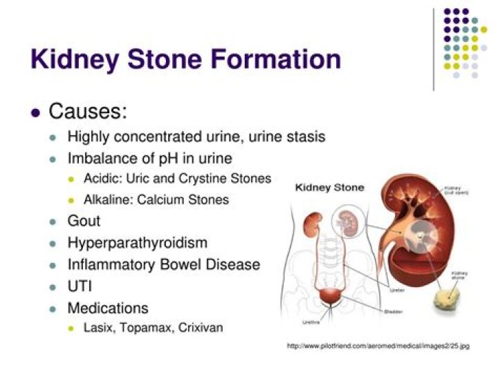 Does high pH cause kidney stones?