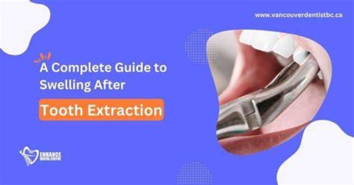 Is it normal for cheek to swell after tooth extraction?