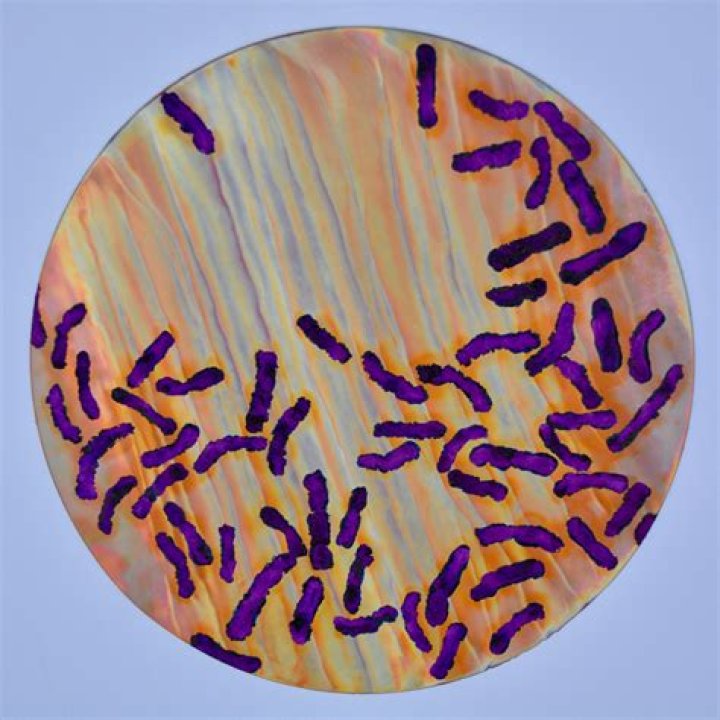 What is example purple non-Sulphur bacteria?