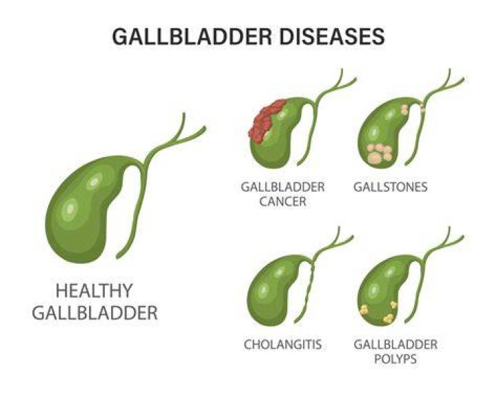 What is the main cause of gallbladder disease?